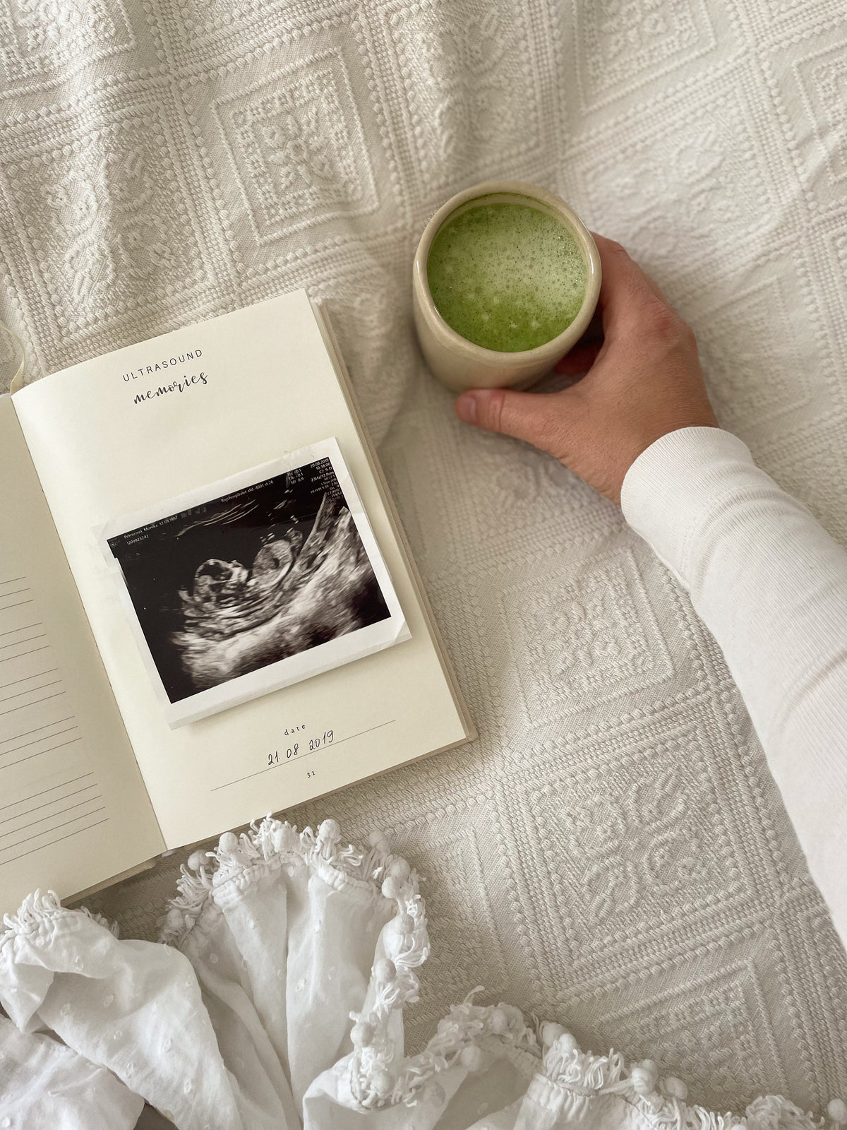 Pregnancy Journal ultrasound memories