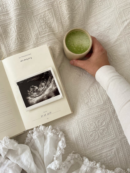 Pregnancy Journal ultrasound memories